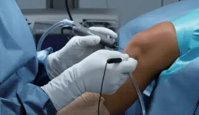 ドクターが手術している写真